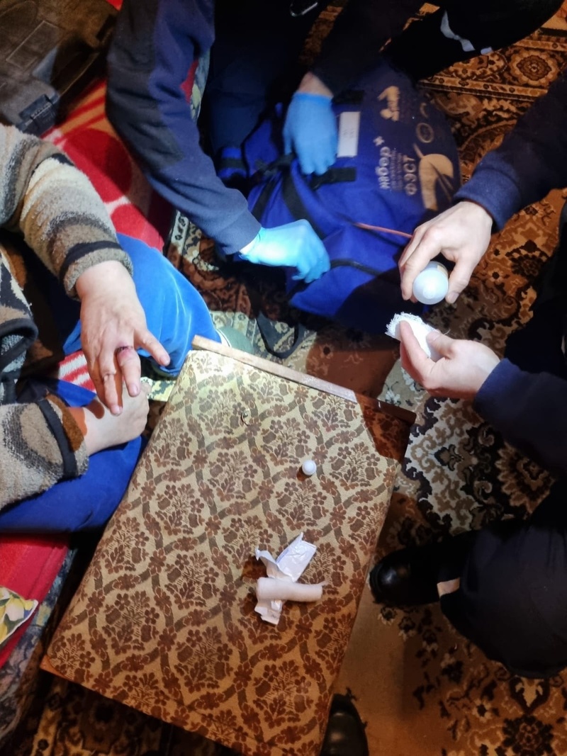 В Нижнем Тагиле спасатели центра защиты помогли женщине снять кольцо с опухшего пальца