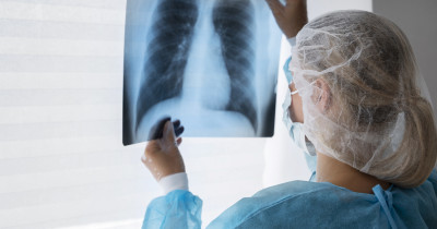 Бронхоэктатическая болезнь: хроническое поражение бронхов и его последствия