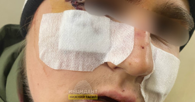 В Нижнем Тагиле школьник жестоко избил ровесника, возбуждено уголовное дело