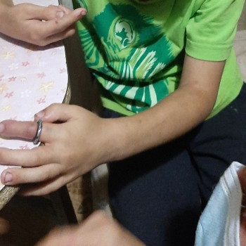 В Нижнем Тагиле спасатели помогли мальчику, палец которого застрял в кольце