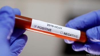 В России зафиксировано 3448 новых случаев коронавируса. Всего в стране почти 28 тысяч заболевших
