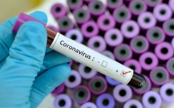 В России подтверждено 4785 случаев коронавируса, 11 — в Свердловской области