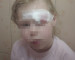 В детском саду Нижнего Тагила 4-летняя девочка получила травму