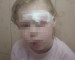 В Нижнем Тагиле прокуратура начала проверку по факту травмирования 4-летней девочки