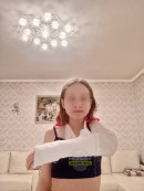 В экопарке Нижнего Тагила девочка упала с двухметровой высоты и повредила руку