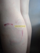 В Нижнем Тагиле прокуратура проводит проверку после сообщения о нападении бездомных собак на 8-летнего ребёнка В Нижнем Тагиле прокуратура проводит проверку после сообщения о нападении бездомных собак на 8-летнего ребёнка