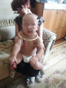 В Нижнем Тагиле спасатели сняли алюминиевое кольцо с шеи годовалого ребёнка