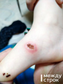 В Нижнем Тагиле трёхлетняя девочка пережила клиническую смерть после удара током от батареи