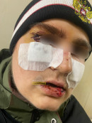 Бастрыкин взял на личный контроль ситуацию с избиением подростка в Нижнем Тагиле